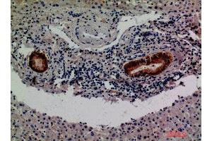 Immunohistochemistry (IHC) analysis of paraffin-embedded Human Liver, antibody was diluted at 1:200. (F13B Antikörper)
