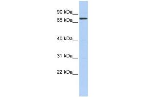 WB Suggested Anti-KLHL5 Antibody Titration:  0. (KLHL5 Antikörper  (N-Term))