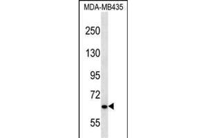 NPHP3 Antibody (N-term) (ABIN656679 and ABIN2845918) western blot analysis in MDA-M cell line lysates (35 μg/lane). (NPHP3 Antikörper  (N-Term))