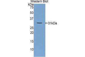 Western blot analysis of the recombinant protein. (OTC Antikörper  (AA 107-350))