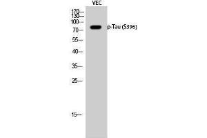 Western Blotting (WB) image for anti-tau Protein (pSer396) antibody (ABIN3172977) (tau Antikörper  (pSer396))