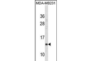IFITM1 Antibody (Center) (ABIN1881445 and ABIN2838626) western blot analysis in MDA-M cell line lysates (35 μg/lane). (IFITM1 Antikörper  (AA 37-66))