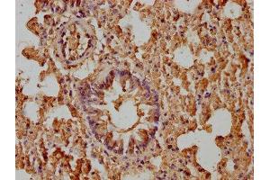 IHC image of ABIN7176993 diluted at 1:400 and staining in paraffin-embedded mouse lung tissue performed on a Leica BondTM system. (beta-2 Microglobulin Antikörper  (AA 21-119))