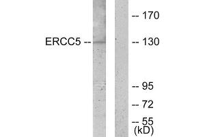 Western Blotting (WB) image for anti-DNA Repair Protein Complementing XP-G Cells (ERCC5) (N-Term) antibody (ABIN1849293) (ERCC5 Antikörper  (N-Term))