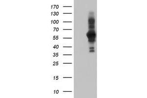 HEK293T cells were transfected with the pCMV6-ENTRY control (Left lane) or pCMV6-ENTRY PDLIM5 (Right lane) cDNA for 48 hrs and lysed. (PDLIM5 Antikörper)