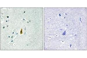 Immunohistochemistry analysis of paraffin-embedded human brain, using p53 (Phospho-Thr81) Antibody. (p53 Antikörper  (pThr81))