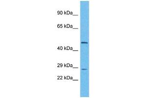 Host: Rabbit Target Name: UTP11L Sample Type: Hela Whole Cell lysates Antibody Dilution: 1. (UTP11L Antikörper  (N-Term))