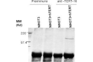 Western Blotting (WB) image for anti-Telomerase Reverse Transcriptase (TERT) (C-Term) antibody (ABIN6655270)