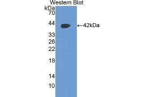 Detection of Recombinant PTH, Mouse using Polyclonal Antibody to Parathyroid Hormone (PTH) (PTH Antikörper  (AA 26-115))