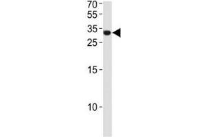 ASCL1 antibody western blot analysis in NCI-H460 lysate. (ASCL1 Antikörper  (AA 63-90))