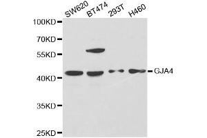 Western Blotting (WB) image for anti-Gap Junction Protein, alpha 4, 37kDa (GJA4) antibody (ABIN1872819) (GJA4 Antikörper)