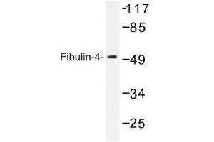 Image no. 1 for anti-Fibulin 4 (FBLN4) antibody (ABIN317833) (FBLN4 Antikörper)