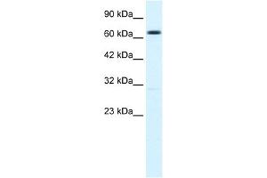 WB Suggested Anti-KCNN2 Antibody Titration:  1. (KCNN2 Antikörper  (C-Term))
