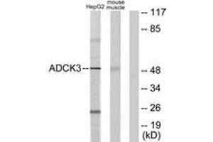 Western Blotting (WB) image for anti-Coenzyme Q8A (COQ8A) (AA 301-350) antibody (ABIN2889684) (COQ8A Antikörper  (AA 301-350))