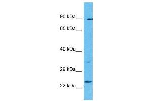 Host: Rabbit Target Name: TBC1D28 Sample Type: Uterus Tumor lysates Antibody Dilution: 1. (TBC1D28 Antikörper  (Middle Region))