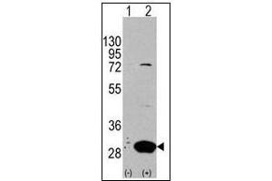Western blot analysis of Latexin (arrow) in 293 cell lysates (2 µg/lane) either nontransfected (Lane 1) or transiently transfected with the LXN gene (Lane 2) (Latexin Antikörper  (Center))