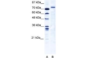 WB Suggested Anti-TRIM9 Antibody   Titration: 2. (TRIM9 Antikörper  (C-Term))