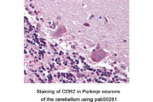 Image no. 1 for anti-Cerebellar Degeneration-Related Protein 2, 62kDa (CDR2) (C-Term) antibody (ABIN363590) (CDR2 Antikörper  (C-Term))