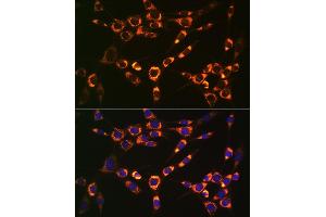 Immunofluorescence analysis of NIH-3T3 cells using PBR/TSPORabbit mAb (ABIN1679051, ABIN3019258, ABIN3019259 and ABIN7101738) at dilution of 1:100 (40x lens). (TSPO Antikörper)