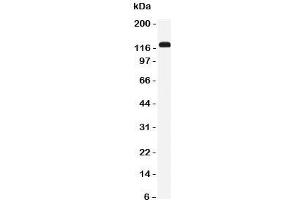 Western blot testing of NKCC2 antibody and rat kidney tissue lysate. (SLC12A1 Antikörper  (N-Term))