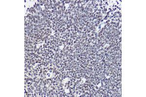 Immunohistochemistry of paraffin-embedded mouse embryos using SOX1 Rabbit pAb (ABIN3017344, ABIN3017345, ABIN3017346 and ABIN1682856) at dilution of 1:25 (40x lens). (SOX1 Antikörper)