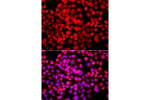 Immunofluorescence analysis of A549 cells using TDP1 antibody (ABIN5975735). (TDP1 Antikörper)