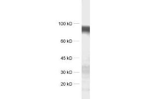 dilution: 1 : 1000, sample: synaptic membrane fraction of rat brain (LP1) (LRRTM4 Antikörper)