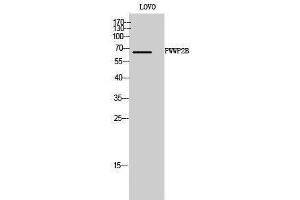 Western Blotting (WB) image for anti-PWWP Domain Containing 2B (PWWP2B) (Internal Region) antibody (ABIN3186604) (PWWP2B Antikörper  (Internal Region))