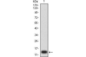 Western blot analysis using CD203C mAb against human CD203C (AA: extra 45-163) recombinant protein. (ENPP3 Antikörper  (AA 45-163))