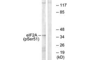 Western Blotting (WB) image for anti-Eukaryotic Translation Initiation Factor 2 Subunit 1 (EIF2S1) (pSer51) antibody (ABIN2888402) (EIF2S1 Antikörper  (pSer51))