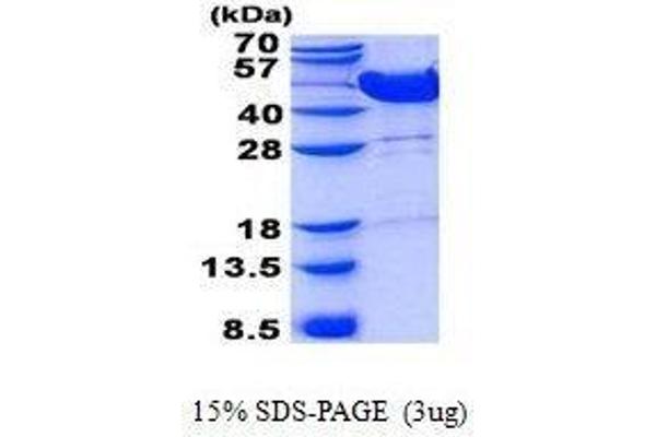 MVK Protein