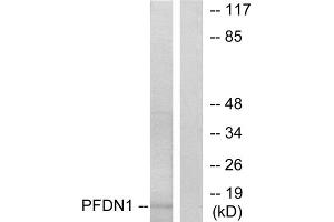 Western blot analysis of extracts from RAW264. (PFDN1 Antikörper  (N-Term))