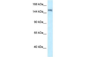 WB Suggested Anti-LRRK1 Antibody Titration: 1. (LRRK1 Antikörper  (N-Term))