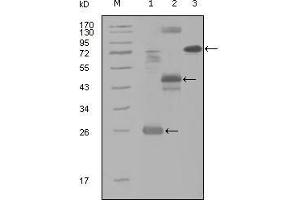 Western Blot showing MAP4K4 antibody used against truncated Trx-MAP4K4 recombinant protein (1), MBP-MAP4K4 (aa300-400) recombinant protein (2) and MAP4K4 (aa194-436)-hIgGFc transfected CH0-K1 cell lysate (3). (MAP4K4 Antikörper  (AA 400-500))