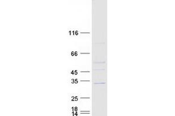 ASB7 Protein (Transcript Variant 1) (Myc-DYKDDDDK Tag)