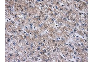 Immunohistochemical staining of paraffin-embedded liver tissue using anti-AKR1A1mouse monoclonal antibody. (AKR1A1 Antikörper)