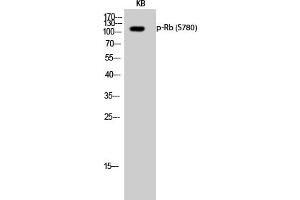 Western Blotting (WB) image for anti-Retinoblastoma 1 (RB1) (pSer780) antibody (ABIN5961788) (Retinoblastoma 1 Antikörper  (pSer780))