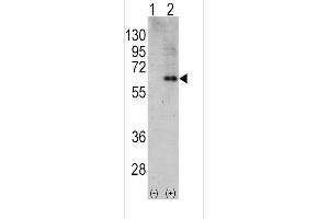 Western blot analysis of PRKAA2 using rabbit polyclonal PRKAA2 Antibody using 293 cell lysates (2 ug/lane) either nontransfected (Lane 1) or transiently transfected with the PRKAA2 gene (Lane 2). (PRKAA2 Antikörper  (C-Term))
