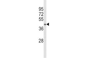 Western Blotting (WB) image for anti-Acyl-CoA Dehydrogenase, Long Chain (ACADL) antibody (ABIN3003793) (ACADL Antikörper)