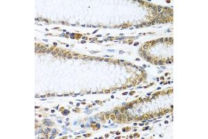 Immunohistochemistry of paraffin-embedded human stomach using IFI44 antibody (ABIN5974803) at dilution of 1/100 (40x lens). (IFI44 Antikörper)