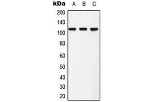 Western blot analysis of EPHB3 (pY608) expression in Hela (A), NIH3T3 (B), PC12 (C) whole cell lysates. (EPH Receptor B3 Antikörper  (pTyr608))