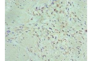 Immunohistochemistry of paraffin-embedded human gallbladder tissue using ABIN7150716 at dilution of 1:100 (MAP2K5 Antikörper  (AA 1-190))