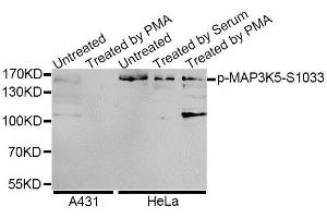 Western blot analysis of extracts of A-431 and HeLa cells, using Phospho-MAP3K5-S1033 antibody (ABIN5995640) at 1/1000 dilution. (ASK1 Antikörper  (pSer1033))
