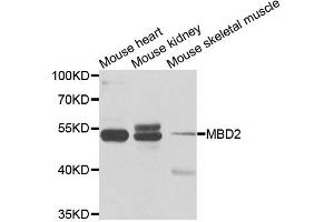 Western blot analysis of extracts of various cell lines, using MBD2 antibody (ABIN5971247) at 1/1000 dilution. (MBD2 Antikörper)