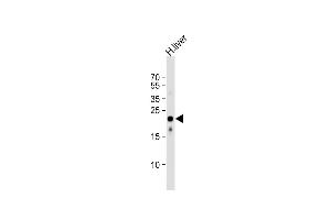 Anti-AB Antibody (Center)at 1:1000 dilution + human liver lysates Lysates/proteins at 20 μg per lane. (MMAB Antikörper  (AA 50-81))