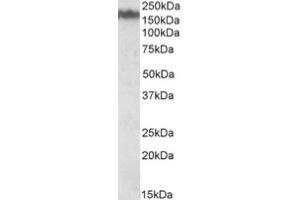 Image no. 1 for anti-Neurofilament Triplet M Protein (NEFM) (Internal Region) antibody (ABIN453988) (NEFM Antikörper  (Internal Region))