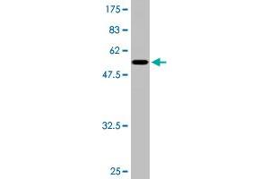 Western Blot detection against Immunogen (51. (TGIF2 Antikörper  (AA 1-237))