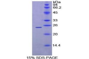 SDS-PAGE analysis of Mouse MPL Protein. (MPL Protein)