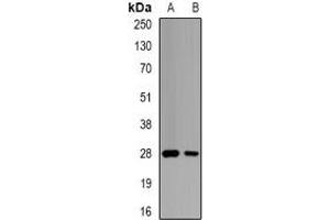 Western blot analysis of GSTO2 expression in mouse pancreas (A), rat testis (B) whole cell lysates. (GSTO2 Antikörper)