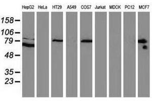 Image no. 2 for anti-Catenin (Cadherin-Associated Protein), beta 1, 88kDa (CTNNB1) antibody (ABIN1496895) (CTNNB1 Antikörper)